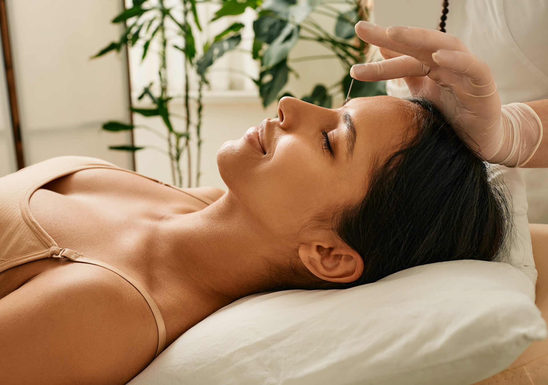 Ein Reflexologe setzt Akupunkturnadeln in einen Akupunkturpunkt am Kopf einer Frau zur Behandlung von Kopfschmerzen. Traditionelle chinesische Medizin